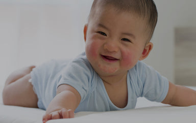 Baby Acne vs Eczema: Understanding the Difference